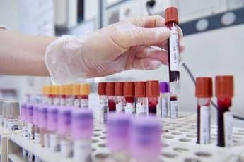 Scienziati più vicini al vaccino anti-Hiv